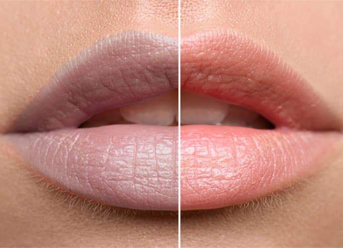 concern-dark-lips-1.jpg