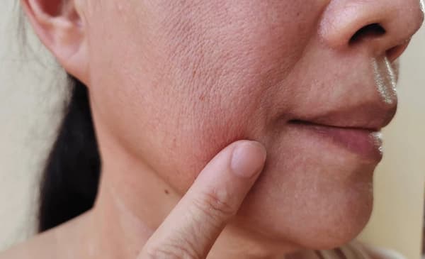 concern-dull-skin-1.jpg