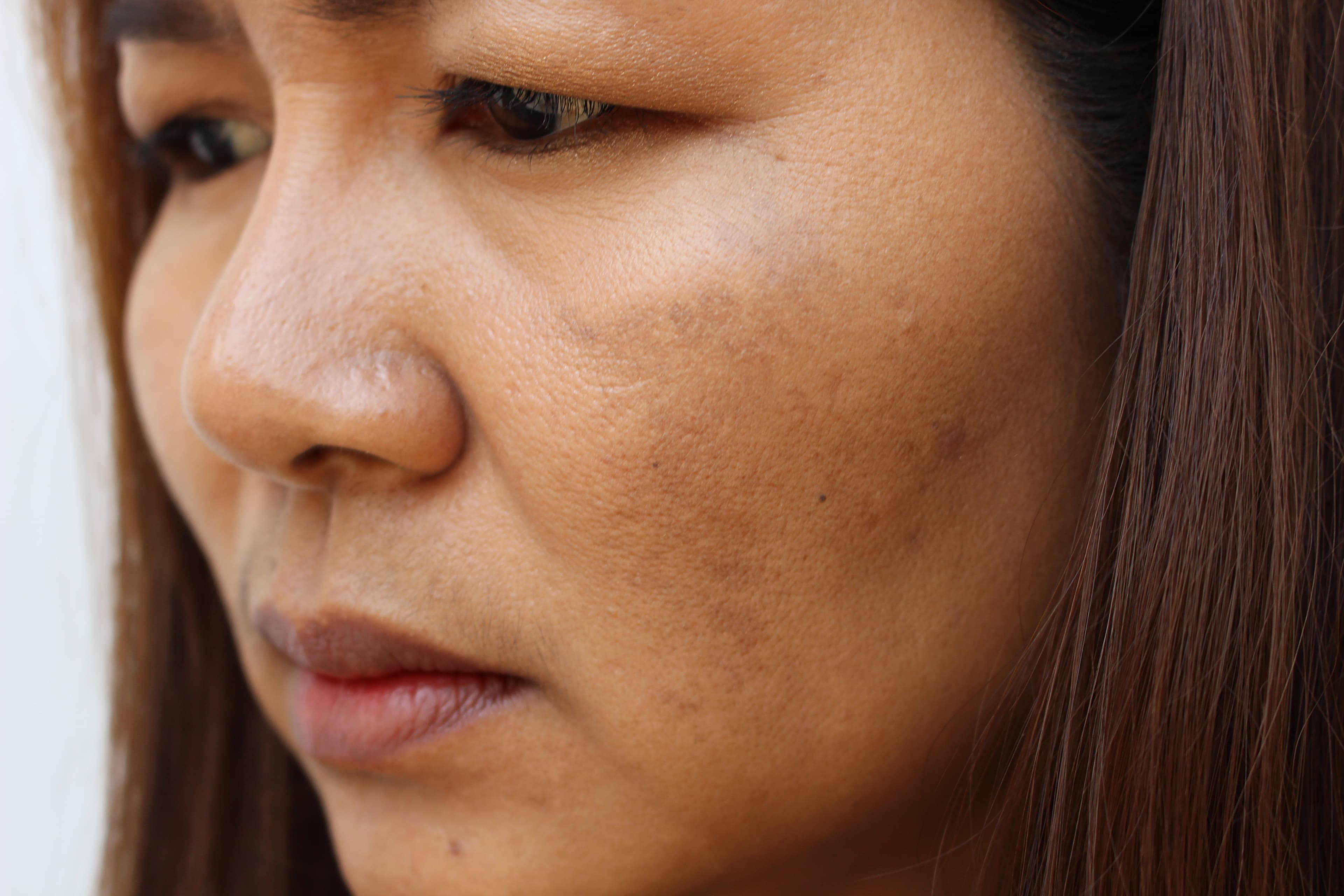 concern-dull-skin-2.jpg