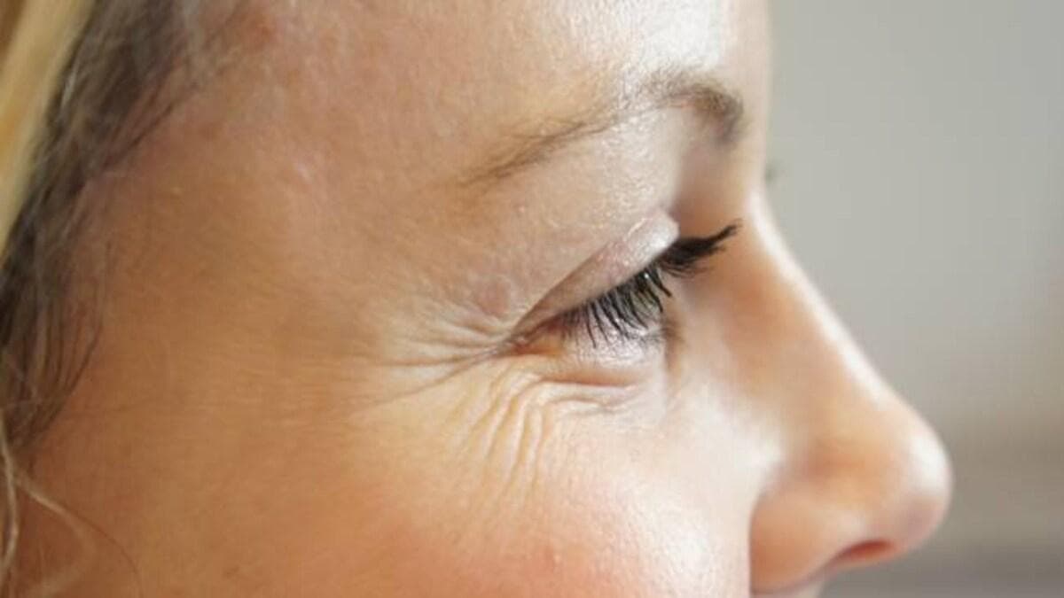 Fine Lines