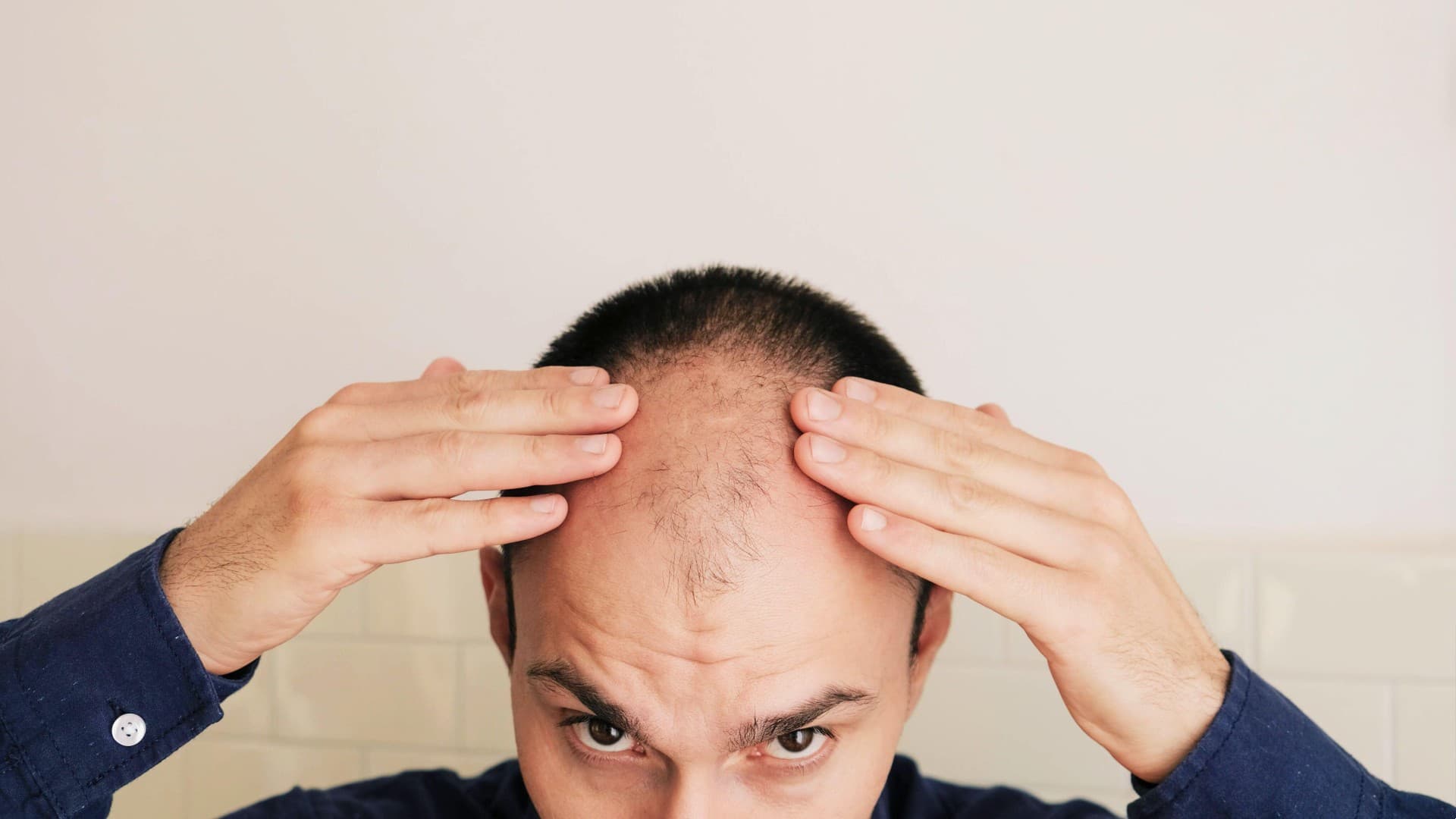 concern-hair-fall-2.jpg