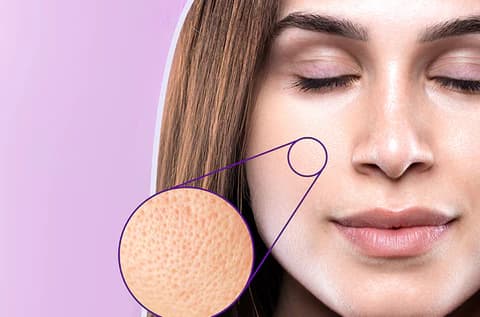 concern-open-pores-2.jpg
