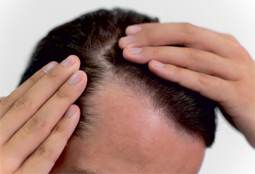 hairfall-iv-1.jpg