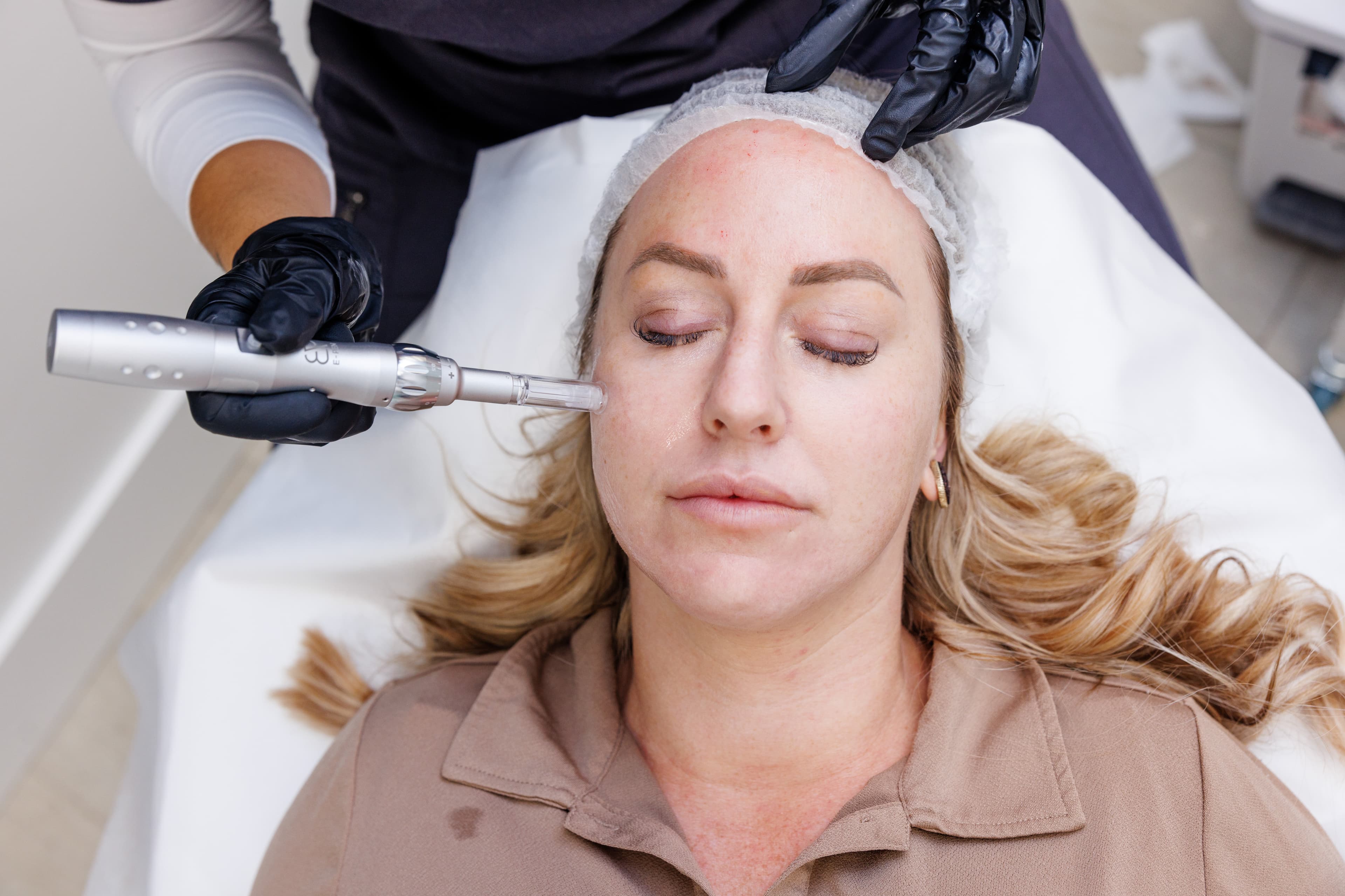 Body Microneedling