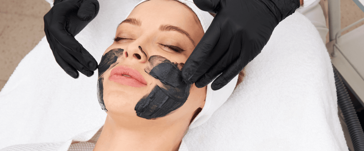 Carbon Facial for Acne and Pimples