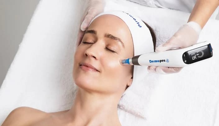 Dermapen4 for Pigmentation
