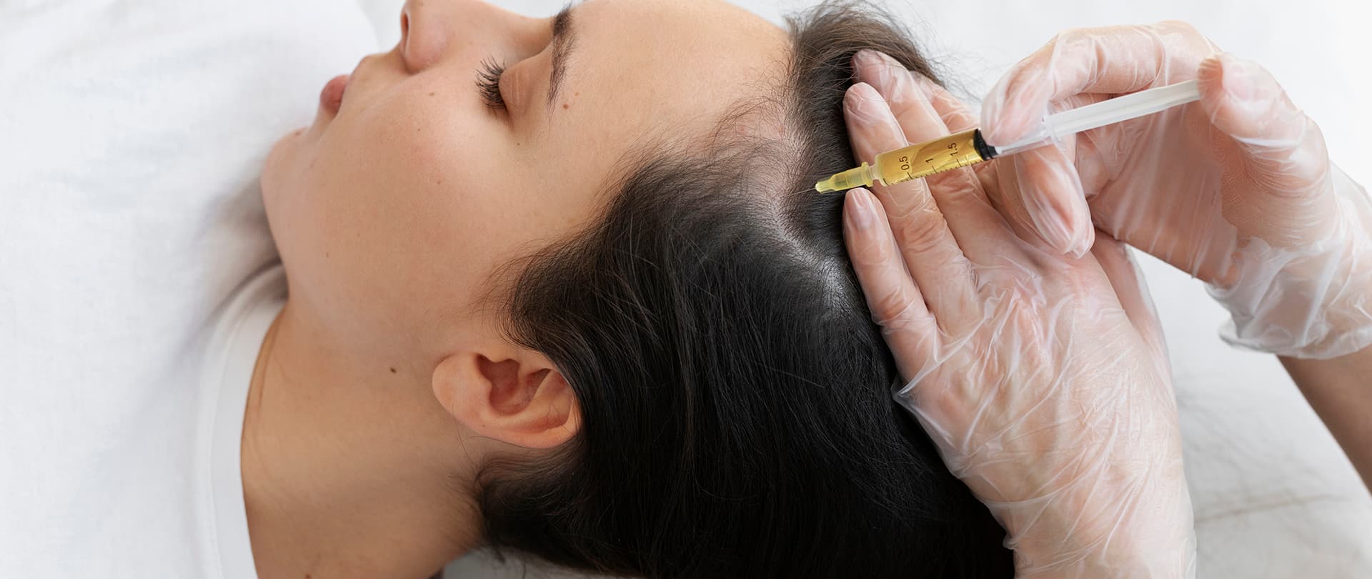 GFC for Hairloss