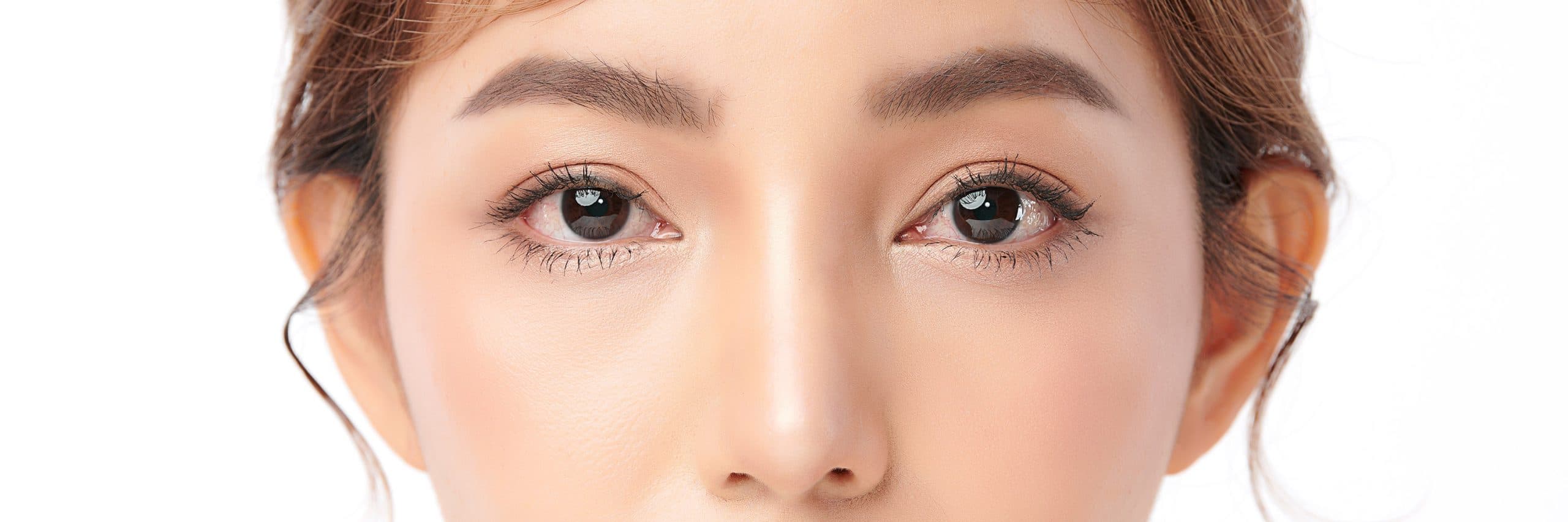 PDRN Therapy for Undereye Dark Circles
